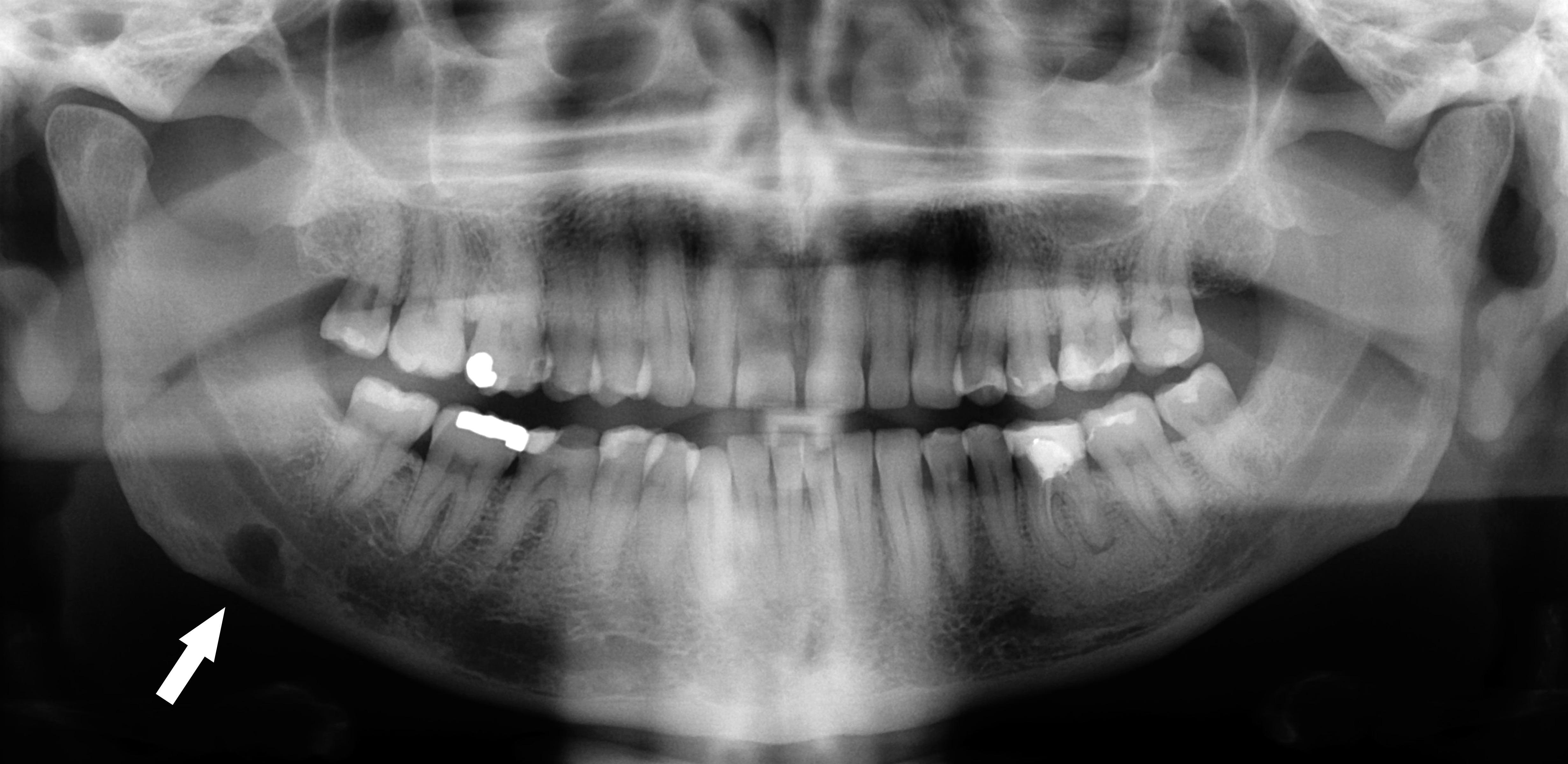 What are the benefits of a dental radiography?